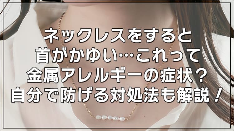 ネックレスで首だけがかゆい…金属アレルギーの症状?自分で防げる対処法も解説!